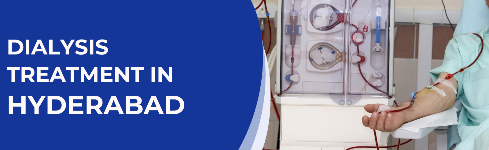 Dialysis Treatment